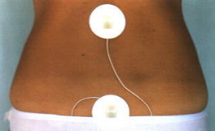 Bei Durchblutungsstörungen