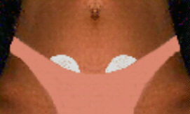 Bei Menstruationsbeschwerden die Pflasterelektroden beiderseits auf druckschmerzhafte Punkte der Bauchwand �ber den Eierst�cken kleben.