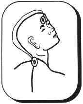 Bei Kopfschmerzen und Migr&auml;ne die Elektroden auf Stirn und siebten Halswirbel