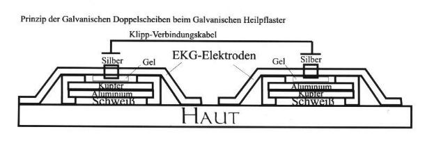 Prinzipschnitt durch das Galvanische Heilpflaster